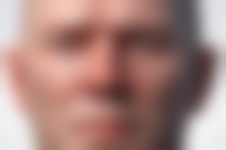 Say Goodbye to Pimple Problems with Brian Armstrong's Face! ?